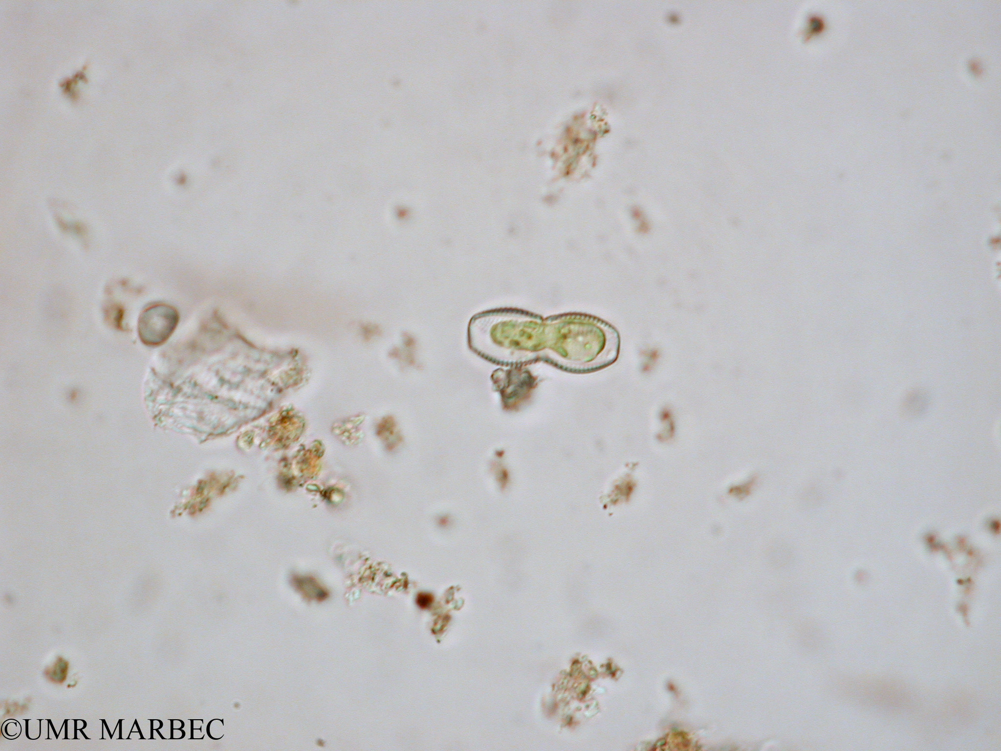 phyto/Tulear Lagoon/all/ICAR2 Avril 2008/Diploneis spp (Surirella sp2 x1.5 x40)(copy).jpg